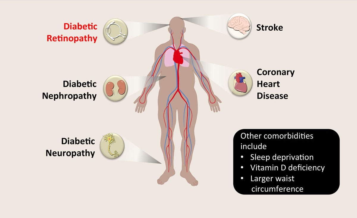 Figure 1. Systemic comorbidities associated with diabetes8-12