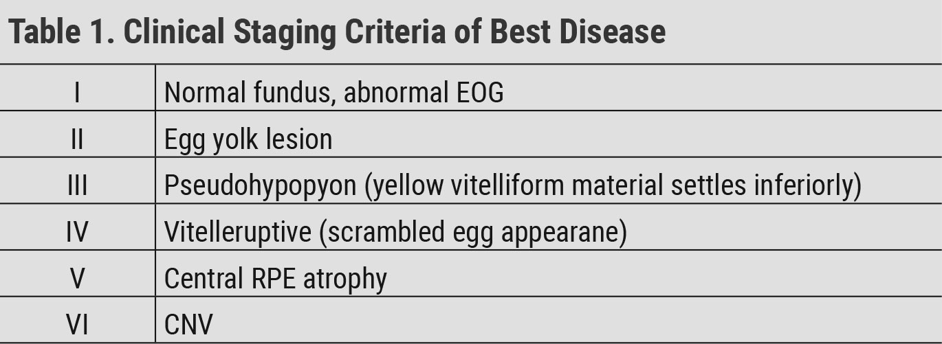 Clinical Staging Criteria of Best Disease