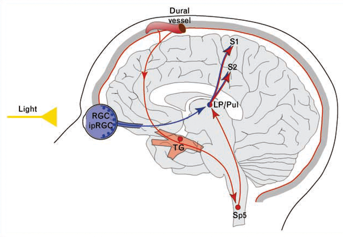 Proposed mechanism for exacerbation of migraine headache by light through convergence of the photic signals from the retina and nociceptive signals from the meninges on the same thalamic neurons that project to the somatosensory cortices. Red depicts the trigeminovascular pathway. Blue depicts the visual pathway from the retina to the posterior thalamus.